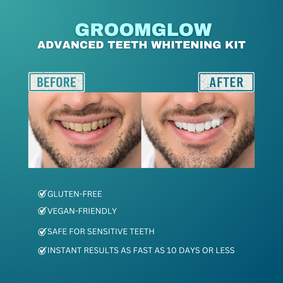 Groom Glow Advanced Teeth Whitening Kit